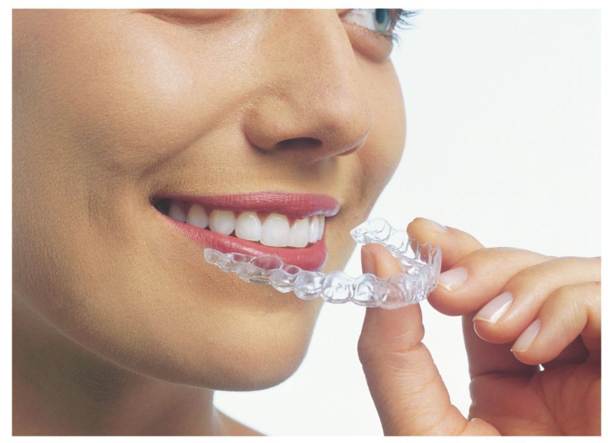 What To Expect From Your Free Orthodontic Consultation